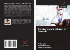 Borítókép a  Przebarwienia zębów i ich leczenie - hoz