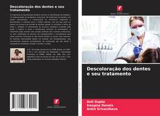 Capa do livro de Descoloração dos dentes e seu tratamento 
