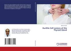 Buchcover von Hurthle Cell Lesions of the Thyroid Gland