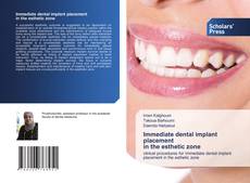 Bookcover of Immediate dental implant placement in the esthetic zone