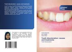 Copertina di Tooth discoloration: causes and treatments