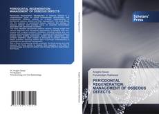 Couverture de PERIODONTAL REGENERATION: MANAGEMENT OF OSSEOUS DEFECTS