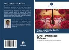 Portada del libro de Akral-lentiginöses Melanom