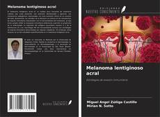 Buchcover von Melanoma lentiginoso acral