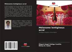 Mélanome lentigineux acral的封面