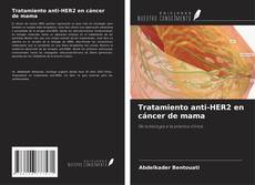 Portada del libro de Tratamiento anti-HER2 en cáncer de mama
