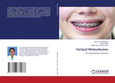 Buchcover von Vertical Malocclusion