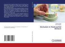 Buchcover von Occlusion in fixed partial denture
