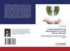 Couverture de Image-Guided Drug Nanosystems in Lung Cancer therapy