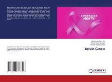 Buchcover von Breast Cancer