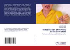 Capa do livro de Rehabilitation of Partially Edentulous State 