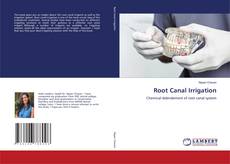 Copertina di Root Canal Irrigation