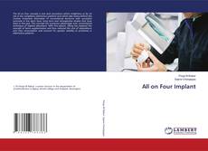 Buchcover von All on Four Implant