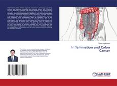 Buchcover von Inflammation and Colon Cancer