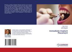 Copertina di Immediate Implant Placement