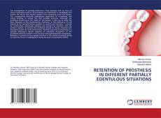 Copertina di RETENTION OF PROSTHESIS IN DIFFERENT PARTIALLY EDENTULOUS SITUATIONS