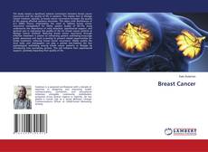 Capa do livro de Breast Cancer 