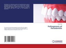 Copertina di Pathogenesis of Periodontitis