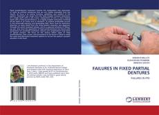 Copertina di FAILURES IN FIXED PARTIAL DENTURES