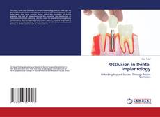 Copertina di Occlusion in Dental Implantology