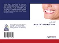 Couverture de Porcelain Laminate Veneers