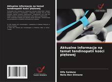 Buchcover von Aktualne informacje na temat tendinopatii kości piętowej
