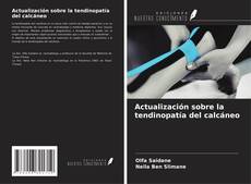 Buchcover von Actualización sobre la tendinopatía del calcáneo