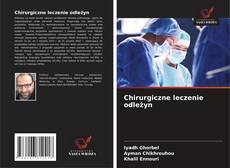 Chirurgiczne leczenie odleżyn的封面