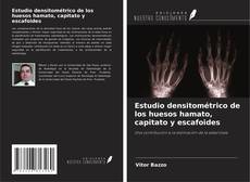 Copertina di Estudio densitométrico de los huesos hamato, capitato y escafoides