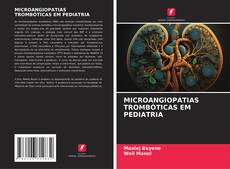 Borítókép a  MICROANGIOPATIAS TROMBÓTICAS EM PEDIATRIA - hoz