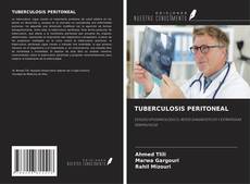 Buchcover von TUBERCULOSIS PERITONEAL
