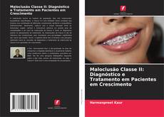 Bookcover of Maloclusão Classe II: Diagnóstico e Tratamento em Pacientes em Crescimento