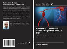 Copertina di Puntuación de riesgo ecocardiográfico tras un SCA