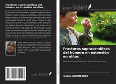 Copertina di Fracturas supracondíleas del húmero en extensión en niños