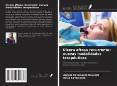 Copertina di Úlcera aftosa recurrente: nuevas modalidades terapéuticas