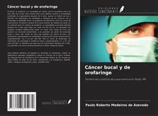 Buchcover von Cáncer bucal y de orofaringe