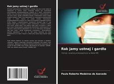 Rak jamy ustnej i gardła的封面