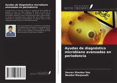 Buchcover von Ayudas de diagnóstico microbiano avanzadas en periodoncia