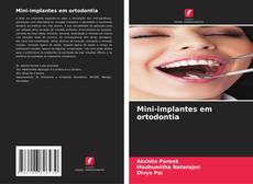 Mini-implantes em ortodontia的封面