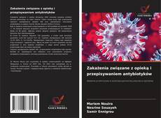 Copertina di Zakażenia związane z opieką i przepisywaniem antybiotyków