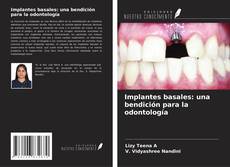 Copertina di Implantes basales: una bendición para la odontología