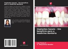 Обложка Implantes basais - Um benefício para a medicina dentária