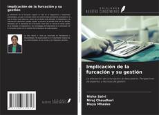 Buchcover von Implicación de la furcación y su gestión