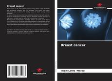 Buchcover von Breast cancer