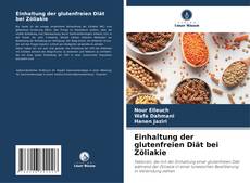 Bookcover of Einhaltung der glutenfreien Diät bei Zöliakie
