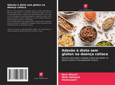 Capa do livro de Adesão à dieta sem glúten na doença celíaca 