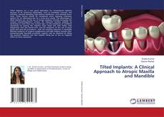 Couverture de Tilted Implants: A Clinical Approach to Atropic Maxilla and Mandible