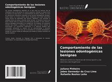 Bookcover of Comportamiento de las lesiones odontogénicas benignas