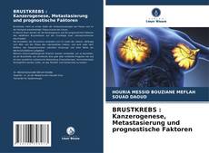 BRUSTKREBS : Kanzerogenese, Metastasierung und prognostische Faktoren kitap kapağı