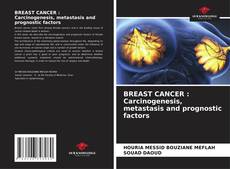 Portada del libro de BREAST CANCER : Carcinogenesis, metastasis and prognostic factors